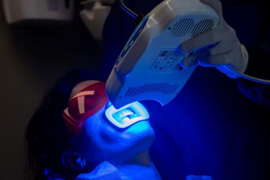 Sbiancamento dentale